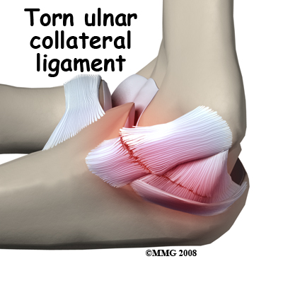 tommy john injuries